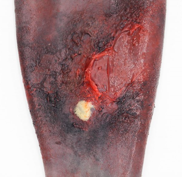 Essential SIMWOUND Burns Kit - Bilde 3