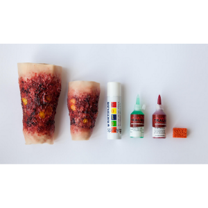 Essential SIMWOUND Burns Kit