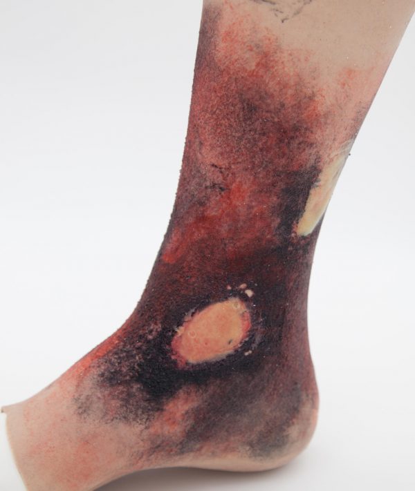 Burns and Blisters Kit - Bilde 7