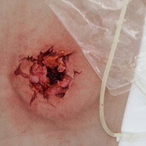 Bleeding sleeves
